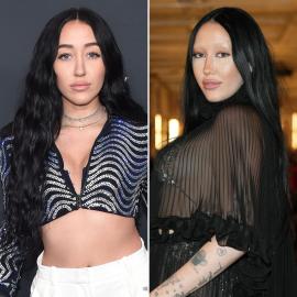 Did Noah Cyrus Ever Get Plastic Surgery? Then and Now Photos