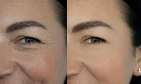 Easier Than Botox! This Night Cream May Improve Fine Lines While You Sleep
