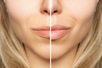 Skip the Filler! This Lip Enhancer Plumps Your Pout Painlessly