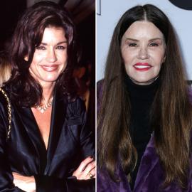 See Janice Dickinson's Plastic Surgery Transformation: Photos