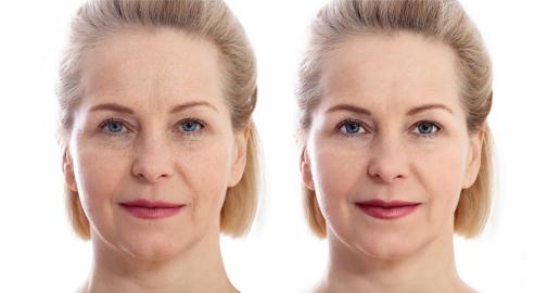 5 Types of Wrinkle Reduction! This Premium Face Cream Is Next Level