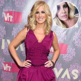 Plastic Surgery? See Kim Zolciak-Biermann's Transformation