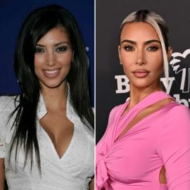 See How Kim Kardashian Looked Before, After Plastic Surgery: Photos