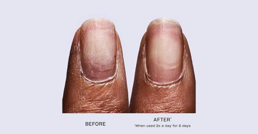 Stronger Nails in 6 Days! This OPI Nail Repair Serum Is Like No Other