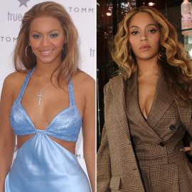 Has Beyonce Had Plastic Surgery? Fans Think She's Denied Rumors: Photos