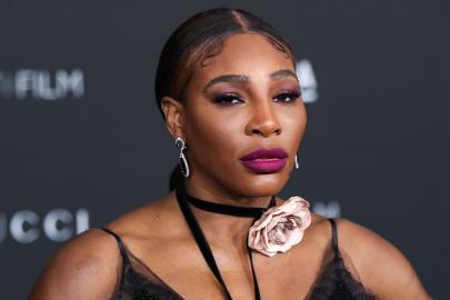 Did Serena Williams Get Plastic Surgery? See Her Before, After Photos