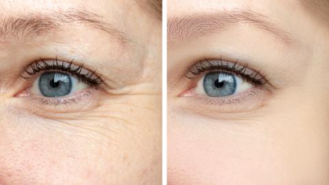 This Tightening Treatment Is Reportedly an Instant Eye Lift in a Tube