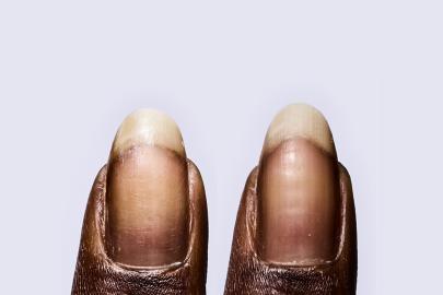 Repair Dry and Damaged Nails in 6 Days With This Strengthening Treatment
