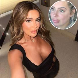 Brielle Biermann Says She 'Went to Too Many Injectors' For Lip Fillers