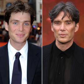 Has Cillian Murphy Had Plastic Surgery? See His Dramatic Transformation