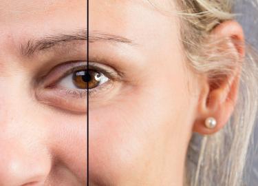 15 Best Dark Circle Treatments on Sale During Prime Day