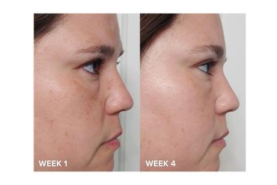 This Bestselling Skincare Secret Weapon Has Over 80,000 Reviews 