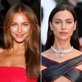 Did Irina Shayk Get Plastic Surgery? See the Model's Transformation Photos