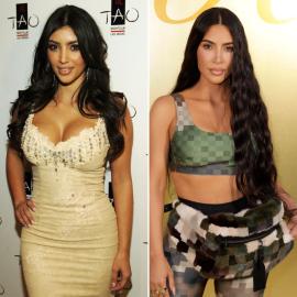 Real or Fake? Everything Kim Kardashian Has Said About Plastic Surgery