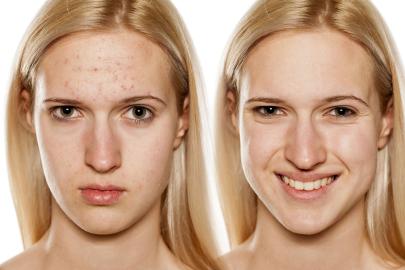 This $15 Retinol Serum Will Resurface and Revitalize Your Skin