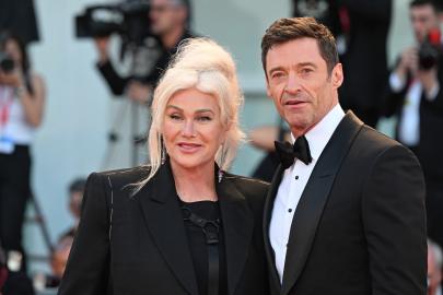 Deborra-Lee Furness Asked About Hugh Jackman Split on Accidental Radio Call