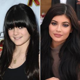 Kylie Jenner Says She's 'Never Touched' Her Face With Plastic Surgery