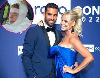 Bravo Star Caroline Stanbury’s Husband Breaks Down Over Her Facelift