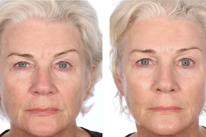 Serious Skincare’s Firming Treatment Makes You Look ‘15 Years Younger’