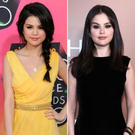 Selena Gomez Confirms She's Gotten Botox Amid Plastic Surgery Rumors