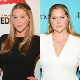 Has Amy Schumer Had Plastic Surgery? See Then, Now Transformation Photos