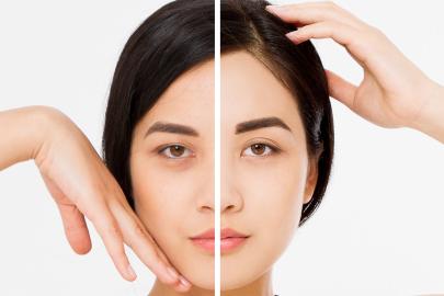 This Cult-Favorite Under-Eye Cream Erases My Dark Circles in Seconds