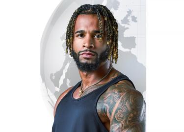 The Challenge's Nelson Thomas Shares Amputation Photos Post-Surgery