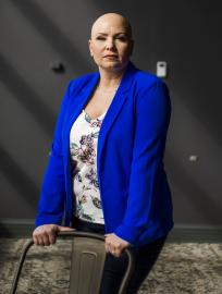 ‘Alopecia Warrior’ McKenna Reitz Talks Being Inspired by Jada Pinkett Smith