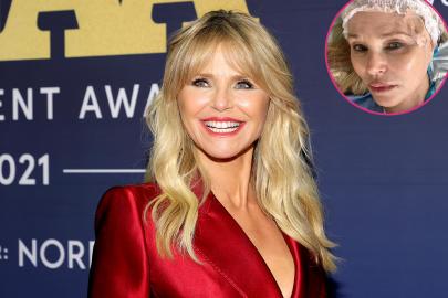 Christie Brinkley Reveals Skin Cancer Diagnosis