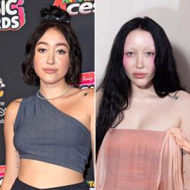 Did Noah Cyrus Ever Get Plastic Surgery? Then and Now Photos