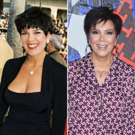 Did Kris Jenner Get Plastic Surgery? Kids Think She's Gone 'Overboard'