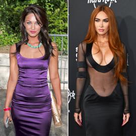 Megan Fox's Plastic Surgery Transformation in Before and After Photos