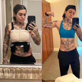 Singer Morgan Wade Is ‘Still Adjusting’ to Her Body After Double Mastectomy