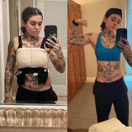 Morgan Wade Details Recovery After Double Mastectomy: Health Updates