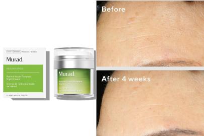 This Murad Retinol Youth Renewal Night Cream is Only $79 at Amazon