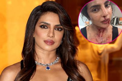 Priyanka Chopra Is Bruised and Bloody on Set of New Movie ‘The Bluff’