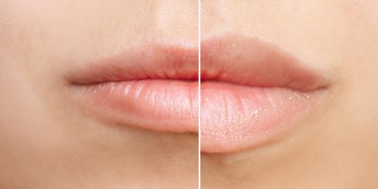 This Affordable Retinol Lip Serum Plumps Lips and Minimizes Wrinkles