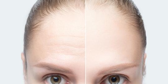 This $33 Moisturizer 'Removes Forehead Wrinkles' and 'Feels Like Silk'