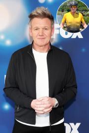 Gordon Ramsay Shows Gruesome Bruises After Bike Accident: 'Lucky to Be Here'