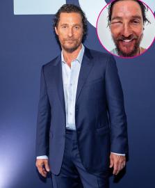 Matthew McConaughey’s Eye Is Swollen Shut After Bee Sting