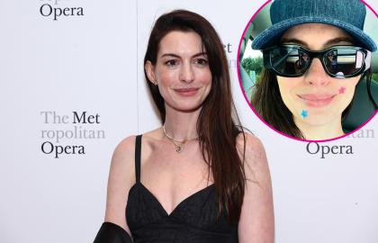 Anne Hathaway Knows She's Really 'Just Like Us,' Shows Off Pimple Patches