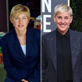 Did Ellen DeGeneres Get Plastic Surgery? Then, Now Transformation Photos