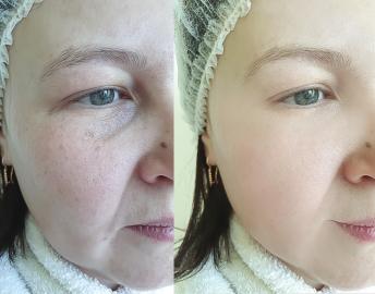 The 4 Beauty Products That Faded My Dark Spots In 1 Month