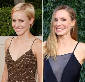 Did Kristen Bell Get Veneers? Doctor Weighs In on If She Got Teeth Done