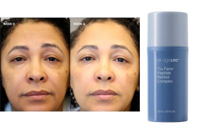 This AI-Enhanced Peptide Retinol Can Help Combat Signs of Aging