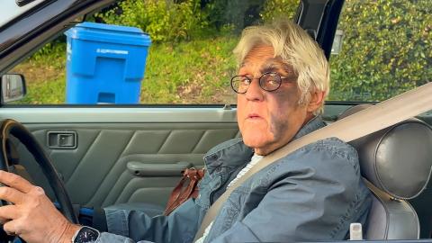 Jay Leno Spotted With Bruise Taking Up Half His Face