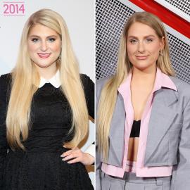 Meghan Trainor Reveals Plastic Surgery Plans: Photos of Her Transformation