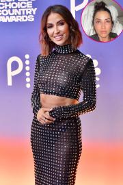 Kaitlyn Bristowe Shares Photos After Undergoing Eyelid Surgery