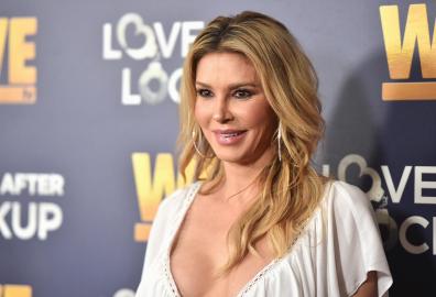 Brandi Glanville Accepts Terry Dubrow’s Help Amid Face Parasite Fears
