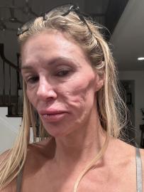 Brandi Glanville Shares New Selfie Amid Health Issues: 'Suck It Haters'